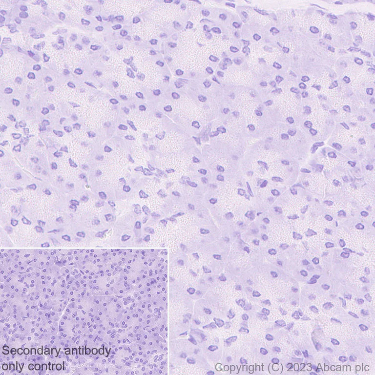 Immunohistochemistry (Formalin/PFA-fixed paraffin-embedded sections) - Anti-MARCO antibody [EPR26935-11] - BSA and Azide free (AB314647)