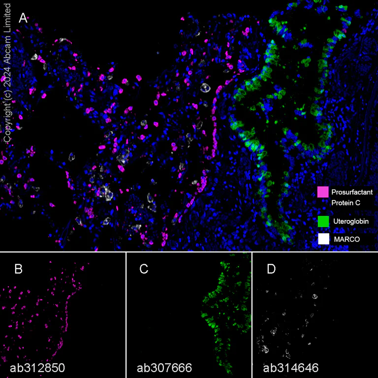 Multiplex immunohistochemistry - Anti-MARCO antibody [EPR26935-11] - BSA and Azide free (AB314647)