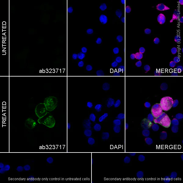 Immunocytochemistry/ Immunofluorescence - Anti-MARCO antibody [RM1219] (AB323717)