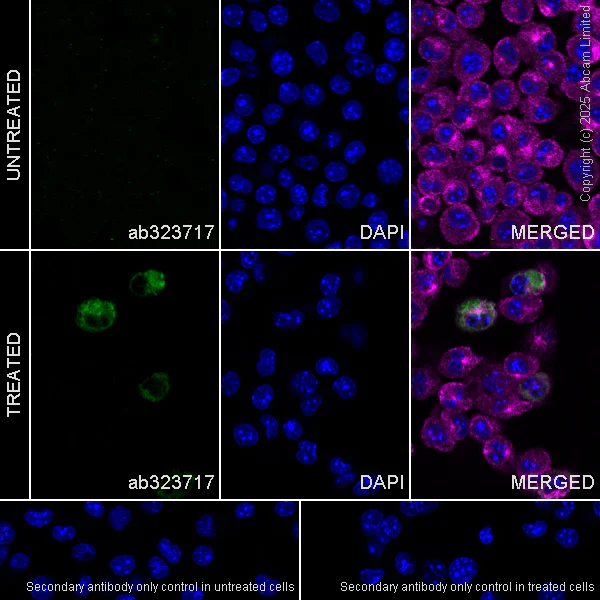 Immunocytochemistry/ Immunofluorescence - Anti-MARCO antibody [RM1219] (AB323717)