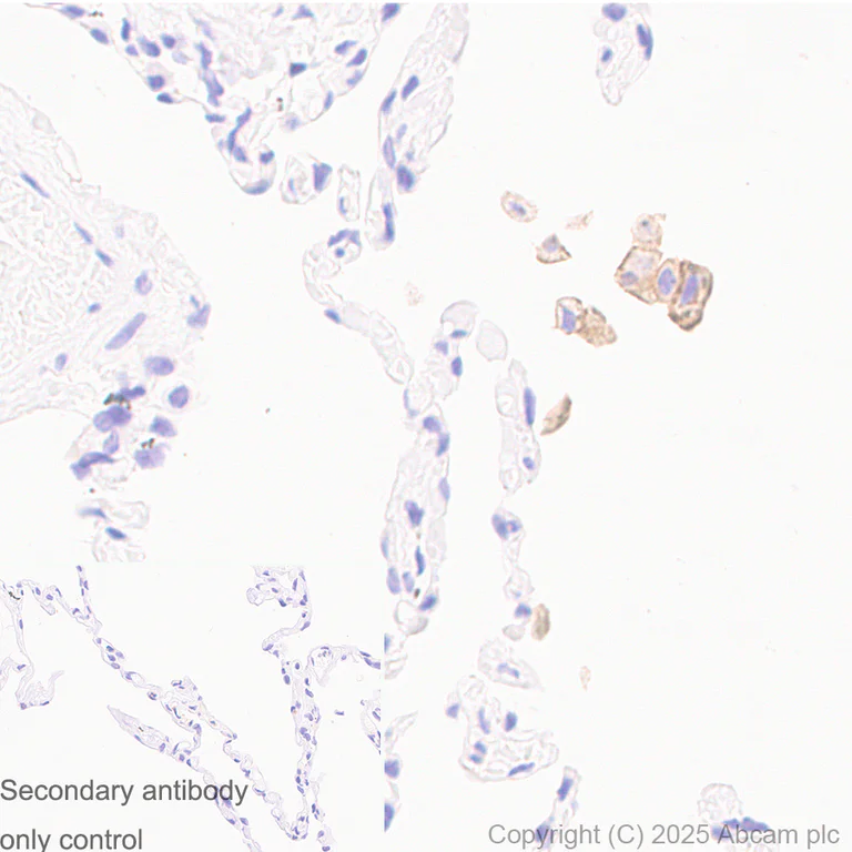 Immunohistochemistry (Formalin/PFA-fixed paraffin-embedded sections) - Anti-MARCO antibody [RM1219] (AB323717)