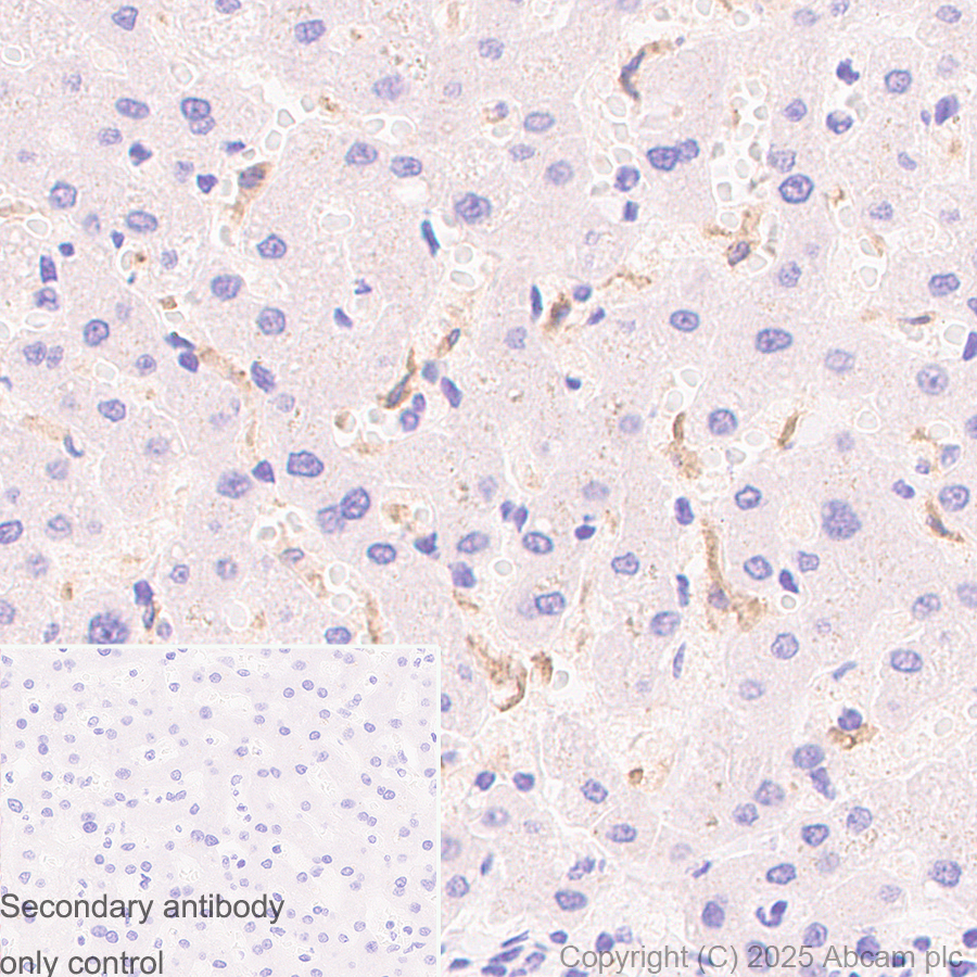 Immunohistochemistry (Formalin/PFA-fixed paraffin-embedded sections) - Anti-MARCO antibody [RM1219] (AB323717)