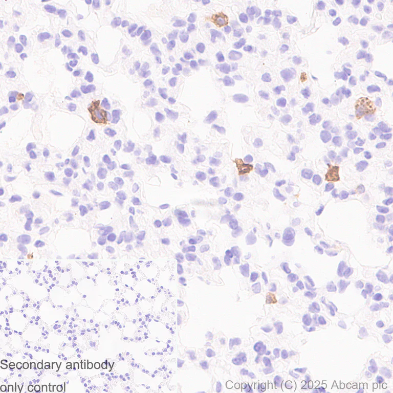 Immunohistochemistry (Formalin/PFA-fixed paraffin-embedded sections) - Anti-MARCO antibody [RM1219] (AB323717)