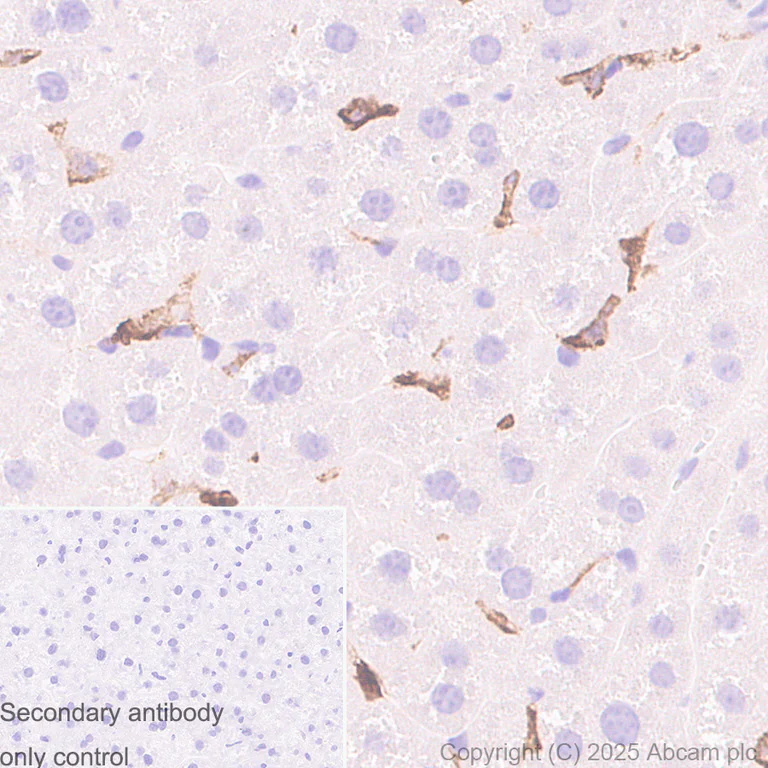 Immunohistochemistry (Formalin/PFA-fixed paraffin-embedded sections) - Anti-MARCO antibody [RM1219] (AB323717)