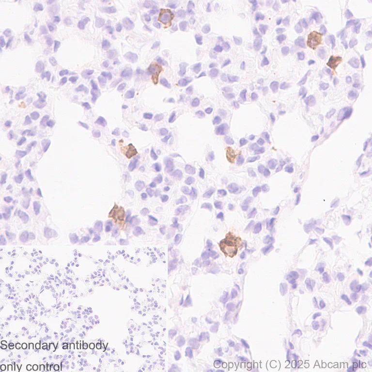 Immunohistochemistry (Formalin/PFA-fixed paraffin-embedded sections) - Anti-MARCO antibody [RM1219] (AB323717)