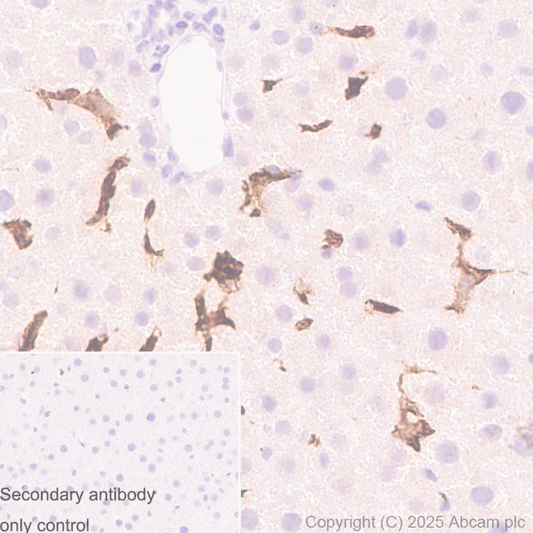 Immunohistochemistry (Formalin/PFA-fixed paraffin-embedded sections) - Anti-MARCO antibody [RM1219] (AB323717)