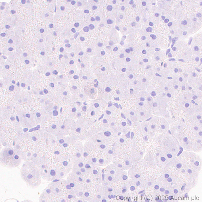 Immunohistochemistry (Formalin/PFA-fixed paraffin-embedded sections) - Anti-MARCO antibody [RM1219] (AB323717)