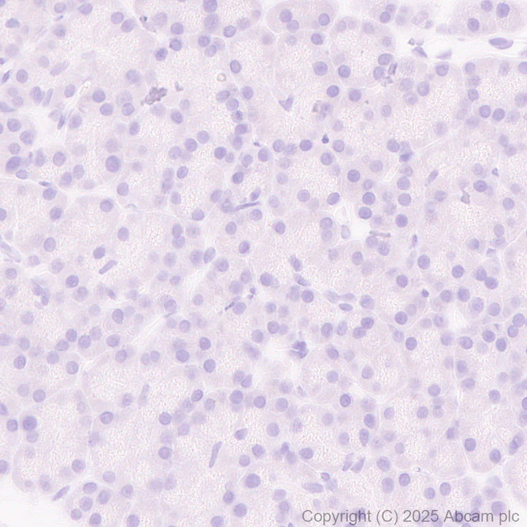 Immunohistochemistry (Formalin/PFA-fixed paraffin-embedded sections) - Anti-MARCO antibody [RM1219] (AB323717)