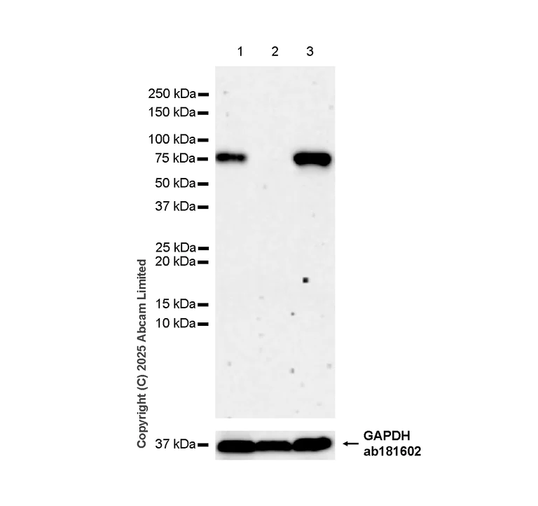 Western blot - Anti-MARCO antibody [RM1219] (AB323717)