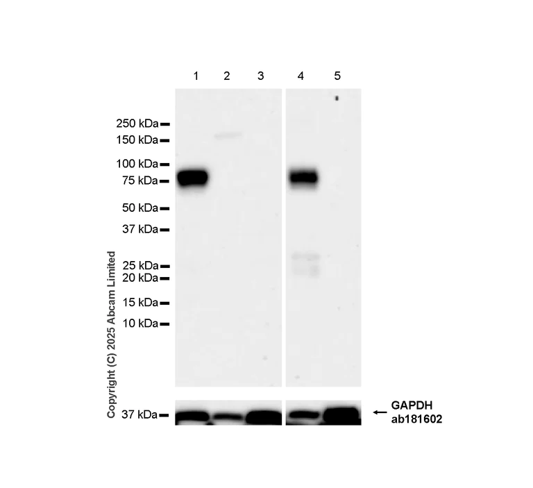 Western blot - Anti-MARCO antibody [RM1219] (AB323717)