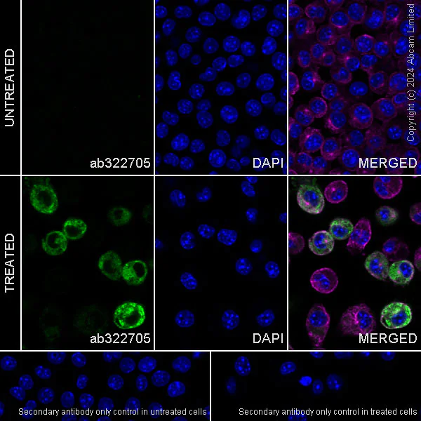 Immunocytochemistry/ Immunofluorescence - Anti-MARCO antibody [RM2074] (AB322705)