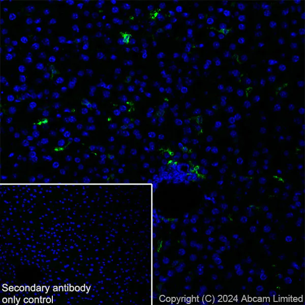 Immunohistochemistry (Frozen sections) - Anti-MARCO antibody [RM2074] (AB322705)