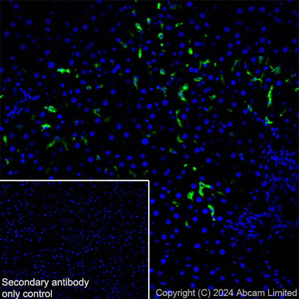 Immunohistochemistry (Frozen sections) - Anti-MARCO antibody [RM2074] (AB322705)