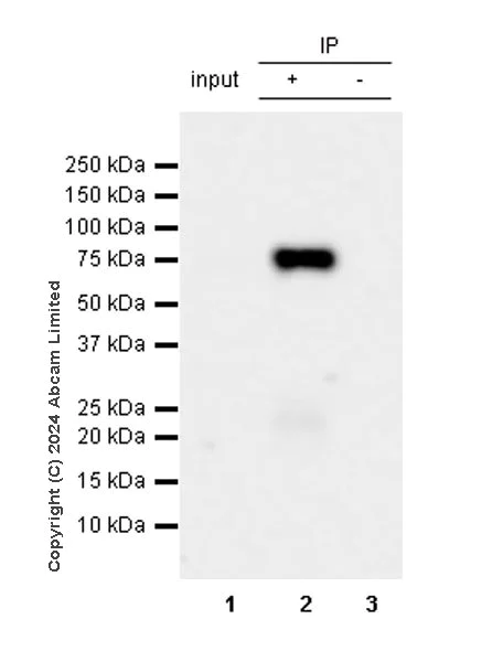 Immunoprecipitation - Anti-MARCO antibody [RM2074] (AB322705)