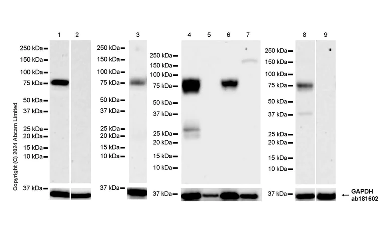 Western blot - Anti-MARCO antibody [RM2074] (AB322705)