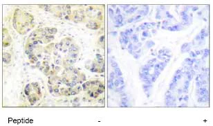 Immunohistochemistry (Formalin/PFA-fixed paraffin-embedded sections) - Anti-MARK 1+2+3+4 antibody (AB74131)