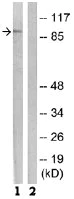Western blot - Anti-MARK 1+2+3+4 antibody (AB74131)