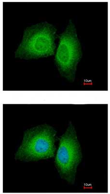 Immunocytochemistry/ Immunofluorescence - Anti-MARK1 antibody - N-terminal (AB154357)