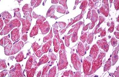 Immunohistochemistry (Formalin/PFA-fixed paraffin-embedded sections) - Anti-MARK2 antibody (AB133178), expandable thumbnail