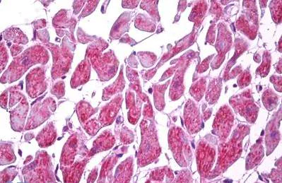 Immunohistochemistry (Formalin/PFA-fixed paraffin-embedded sections) - Anti-MARK2 antibody (AB133178)