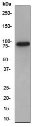 Western blot - Anti-Mark3 antibody [EPR633Y] (ab52626), expandable thumbnail