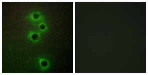 Immunocytochemistry/ Immunofluorescence - Anti-MARK4 antibody (AB124267)