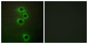 Immunocytochemistry/ Immunofluorescence - Anti-MARK4 antibody (AB124267)
