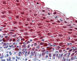 Immunohistochemistry (Formalin/PFA-fixed paraffin-embedded sections) - Anti-MARK4 antibody (AB124267)