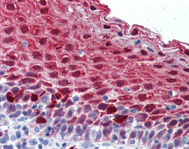 Immunohistochemistry (Formalin/PFA-fixed paraffin-embedded sections) - Anti-MARK4 antibody (AB124267)