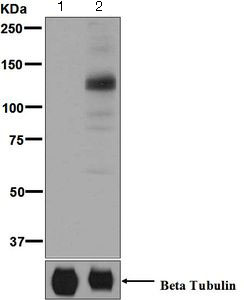 Western blot - Anti-MARK4 (pT214) + MARK2 (pT208) + MARK3 (pT234) + MARK1 (pT215) antibody [EPR5463] (AB126731)