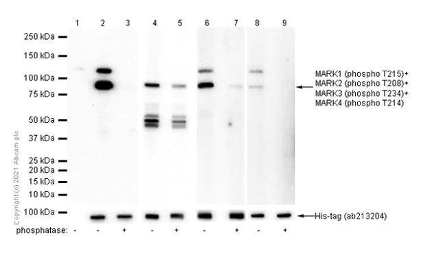 Western blot - Anti-MARK4 (pT214) + MARK2 (pT208) + MARK3 (pT234) + MARK1 (pT215) antibody [EPR5463] (AB126731)