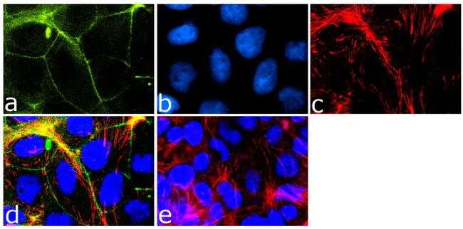 Immunocytochemistry/ Immunofluorescence - Anti-MARVELD2/Tricellulin antibody [54H19L38] (AB203567)