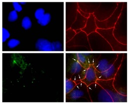 Immunocytochemistry/ Immunofluorescence - Anti-MARVELD2/Tricellulin antibody [54H19L38] (AB203567)