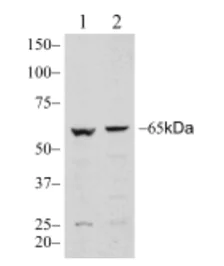 Western blot - Anti-MARVELD2/Tricellulin antibody [54H19L38] (AB203567)