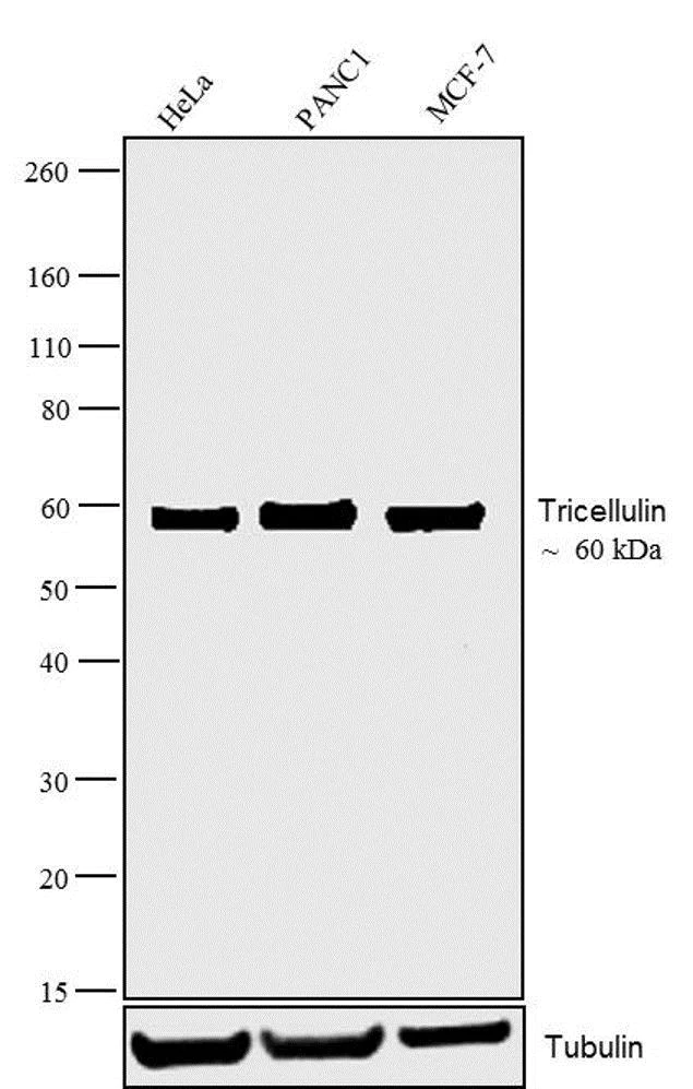 Western blot - Anti-MARVELD2/Tricellulin antibody [54H19L38] (AB203567)
