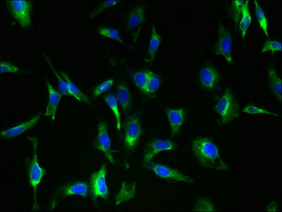 Immunocytochemistry/ Immunofluorescence - Anti-MAS1 antibody (AB235914)