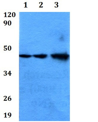 Western blot - Anti-MAS1L antibody (AB200685), expandable thumbnail