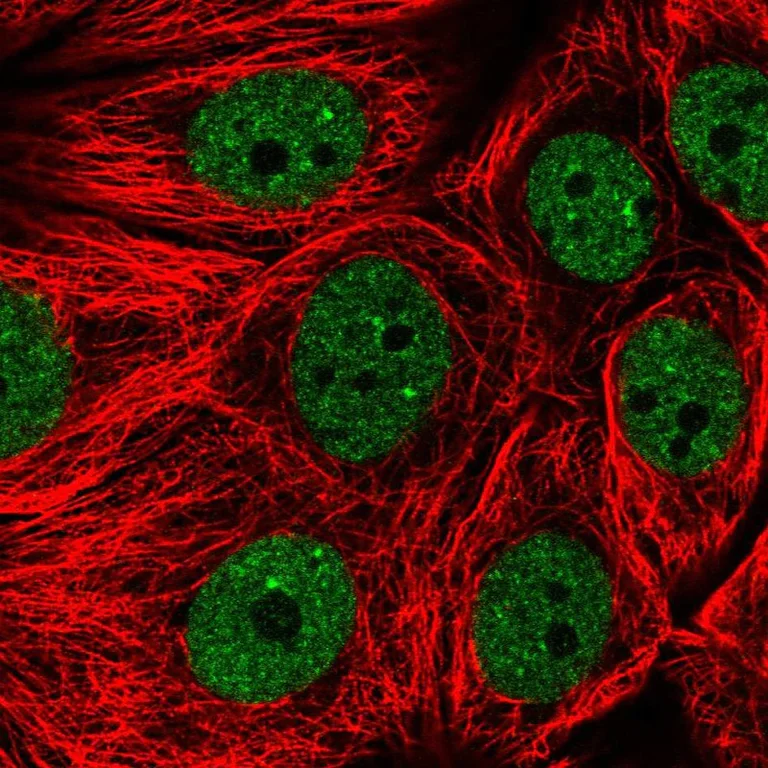 Immunocytochemistry/ Immunofluorescence - Anti-MASA antibody (AB252962)