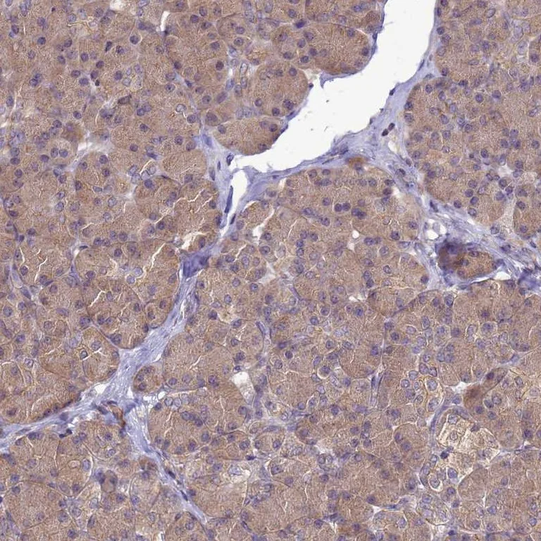 Immunohistochemistry (Formalin/PFA-fixed paraffin-embedded sections) - Anti-MASA antibody (AB252962)