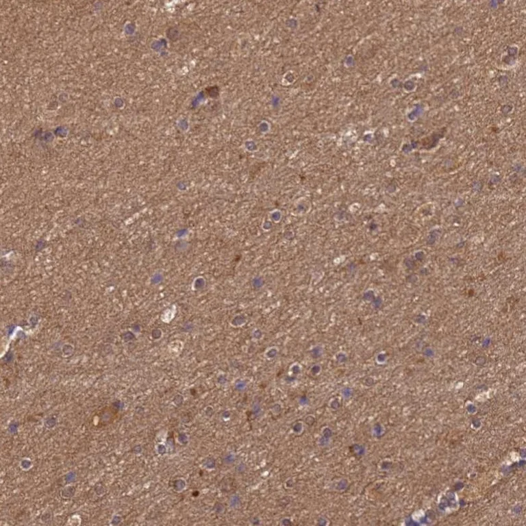 Immunohistochemistry (Formalin/PFA-fixed paraffin-embedded sections) - Anti-MASA antibody (AB252962)