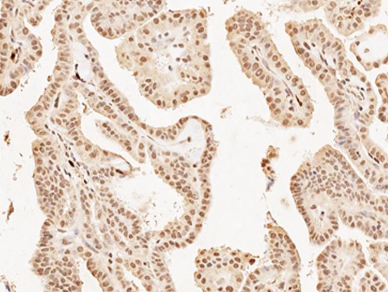 Immunohistochemistry (Formalin/PFA-fixed paraffin-embedded sections) - Anti-MASH1/Achaete-scute homolog 1 antibody (AB235198)