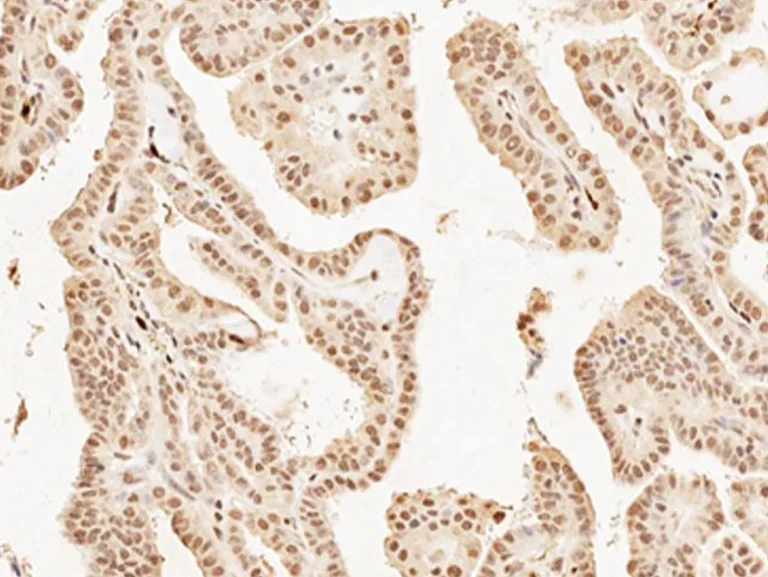 Immunohistochemistry (Formalin/PFA-fixed paraffin-embedded sections) - Anti-MASH1/Achaete-scute homolog 1 antibody (AB235198)