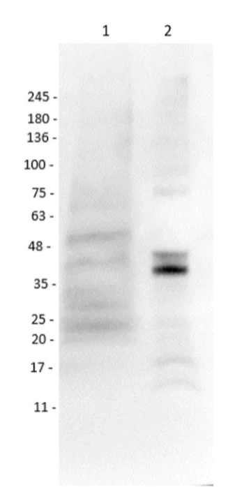 Western blot - Anti-MASH1/Achaete-scute homolog 1 antibody (AB235198)