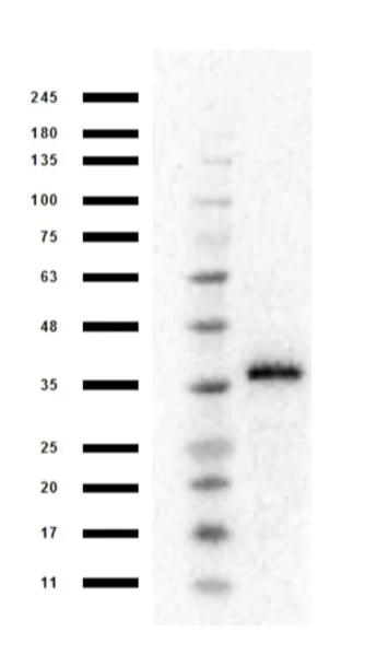 Western blot - Anti-MASH1/Achaete-scute homolog 1 antibody (AB235198)