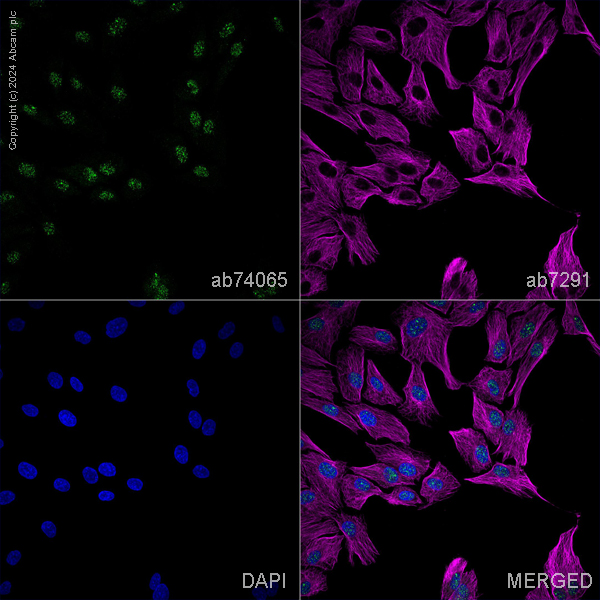 Immunocytochemistry/ Immunofluorescence - Anti-MASH1/Achaete-scute homolog 1 antibody (AB74065), expandable thumbnail