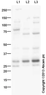 Western blot - Anti-MASH1/Achaete-scute homolog 1 antibody (AB74065)