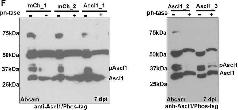 Western blot - Anti-MASH1/Achaete-scute homolog 1 antibody (AB74065)