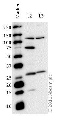 Western blot - Anti-MASH1/Achaete-scute homolog 1 antibody (AB74065), expandable thumbnail
