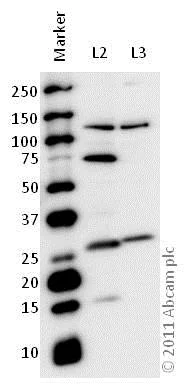Western blot - Anti-MASH1/Achaete-scute homolog 1 antibody (AB74065)