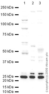 Western blot - Anti-MASH1/Achaete-scute homolog 1 antibody (AB74065), expandable thumbnail